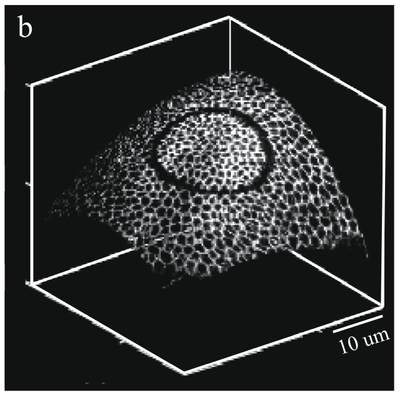 Adaptive laser dissection