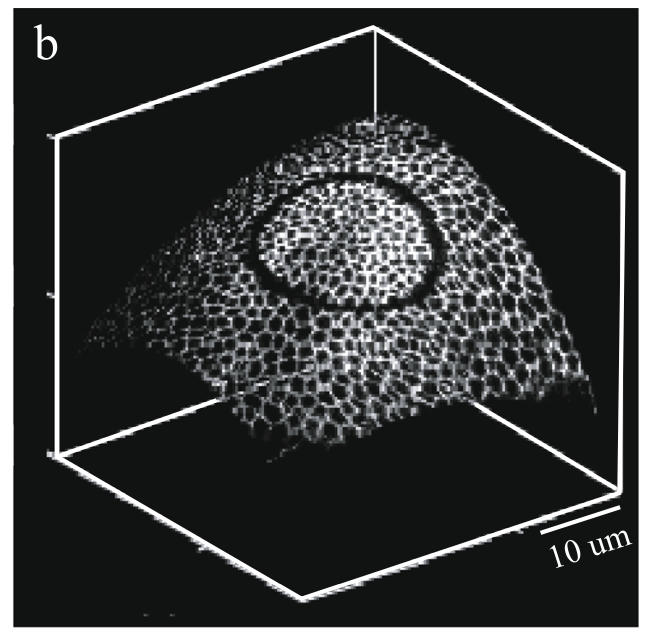 Adaptive laser dissection trajectory on a curved epithelial surface