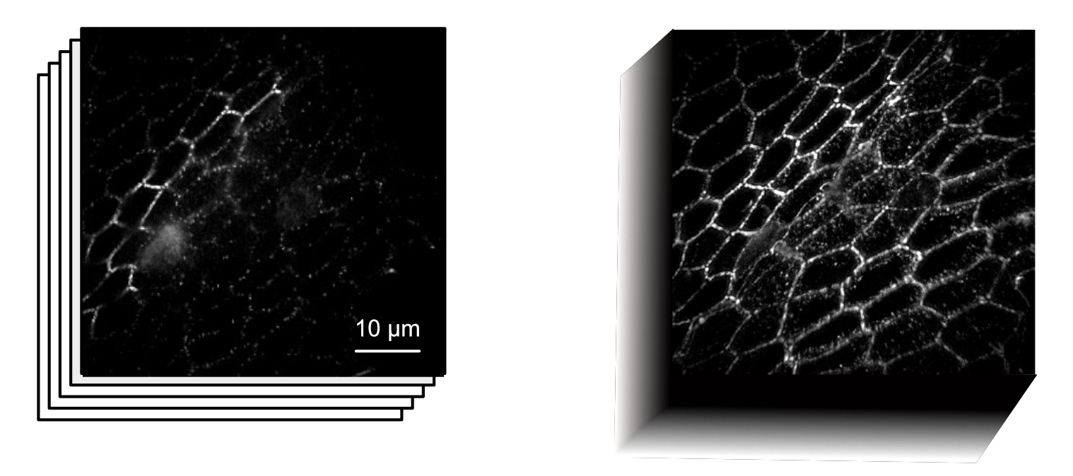 Sequential 2D RIM slices versus a single EDF-RIM projection of the same tissue