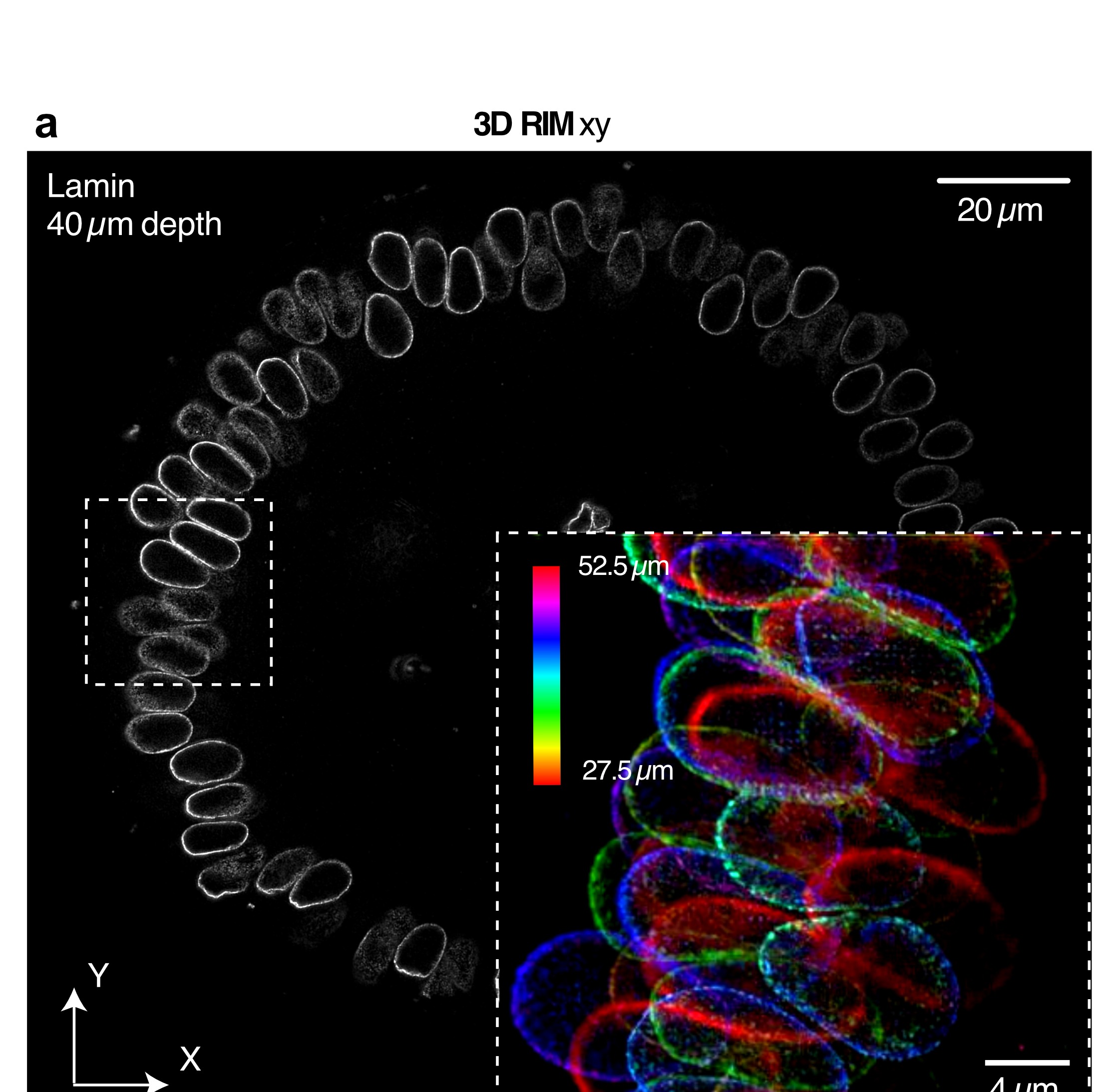 3D-RIM xy view of Drosophila embryo nuclei labeled for lamin