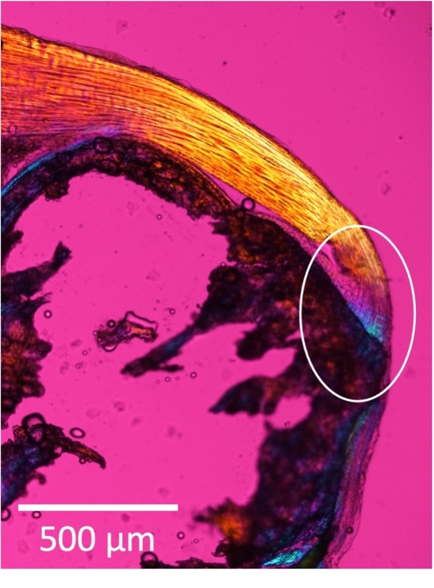 Fig 2: Polarized light microscope image of the enthesis