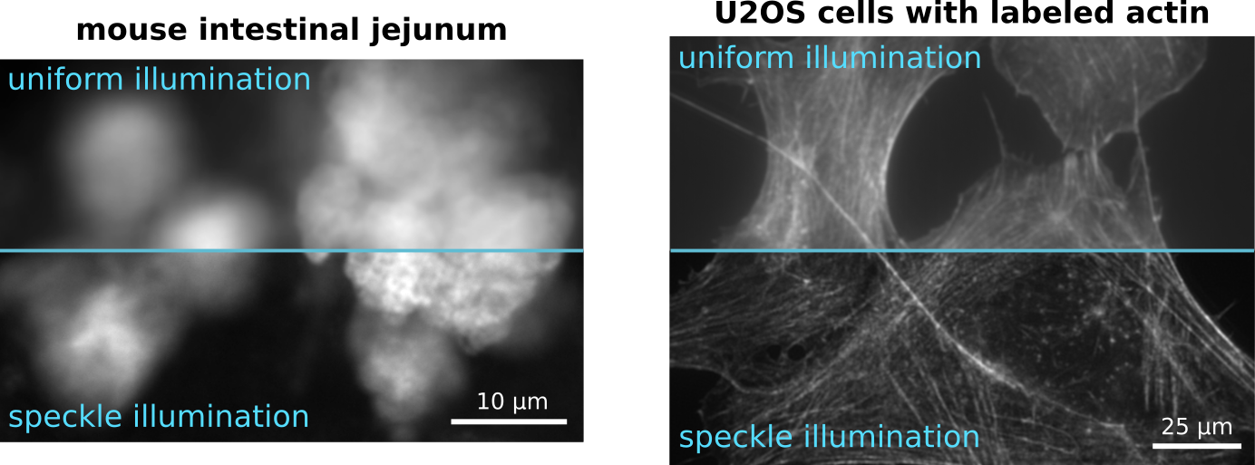 Figure Speckle illumination