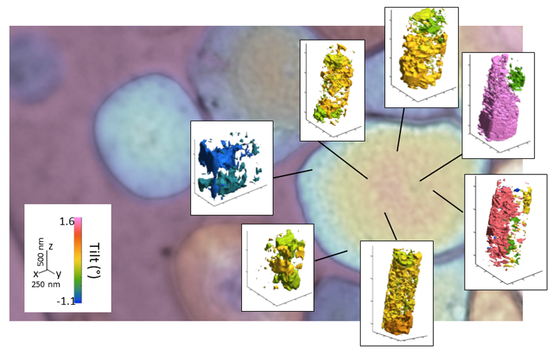 Image Ptychographie de Bragg 3D et biominéralisation